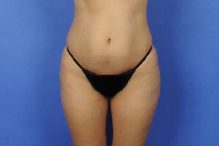 Case 30951 Before