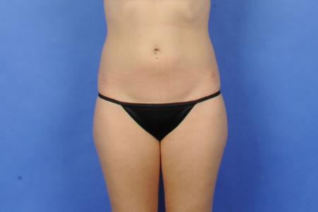 Case 30956 Before